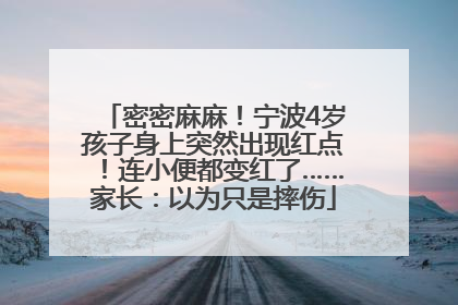 密密麻麻！宁波4岁孩子身上突然出现红点！连小便都变红了……家长：以为只是摔伤